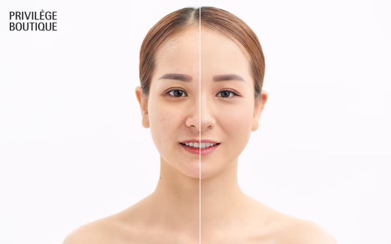 Before and after comparison of modern facial rejuvenation treatment.