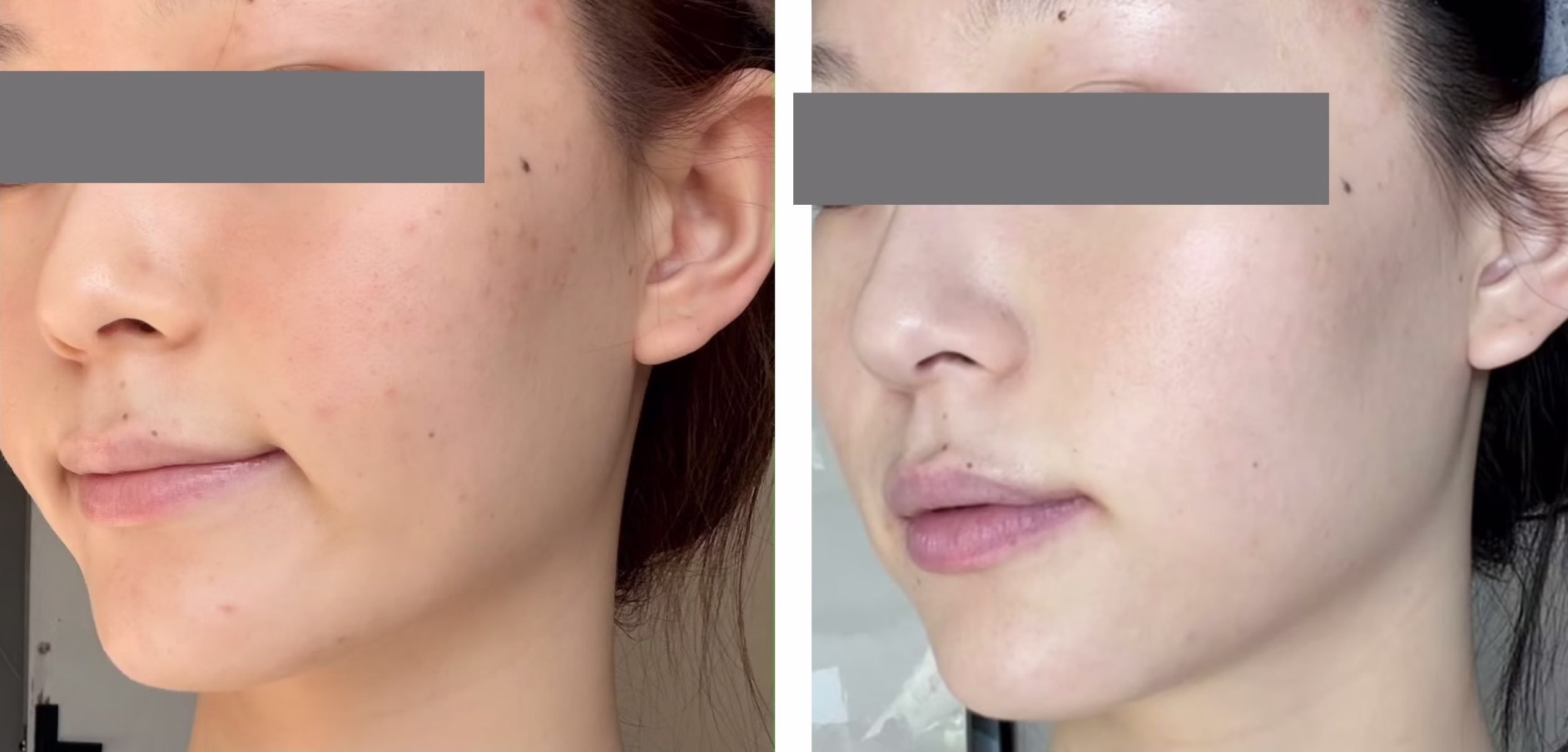Before After