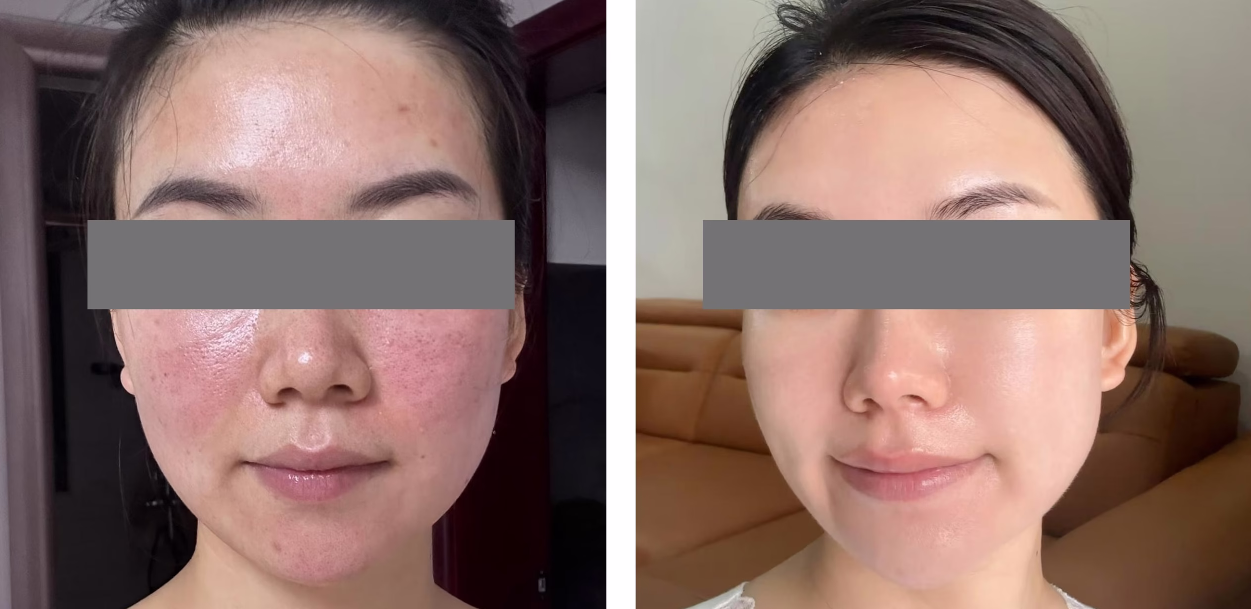 Before After